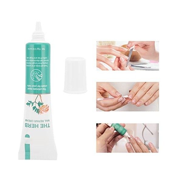 Traitement Fongique des Ongles, Crème de Réparation des Ongles Crème de Protection des Ongles Nourrissante pour Lélimination