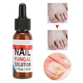 Renouvellement fongique des ongles, prévenir une infection Traitement des mycoses des ongles Ongle du doigt pour le traitemen