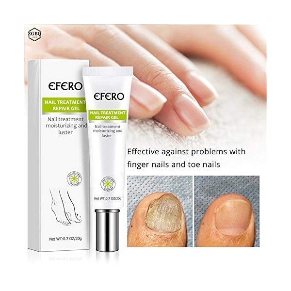 Gel de réparation de traitement des ongles enlever lonychomycose ongles cassés crème de réparation des ongles antifongiques 