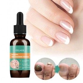 MSLing Kit de traitement anti-fongique pour les ongles des doigts et des orteils - 30 ml