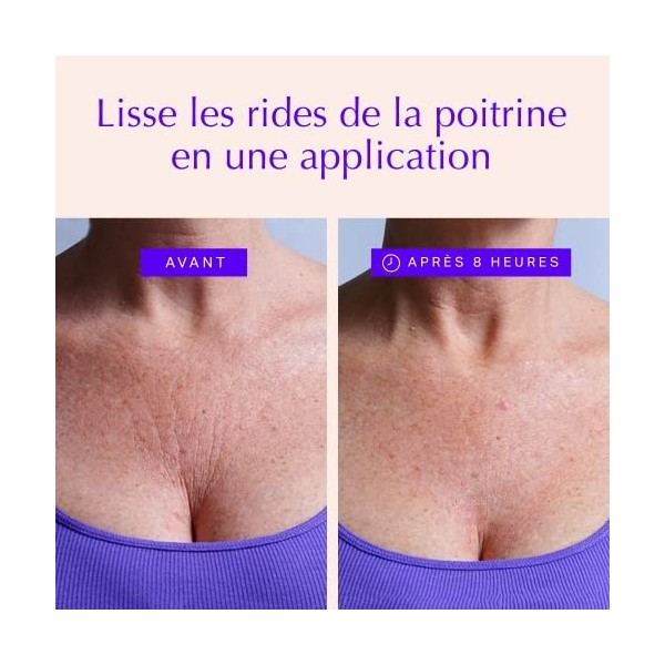 Patchs Anti Rides Réutilisables Pour Décolleté - Pour Une Peau Plus Lisse, Jeune & Radieuse - Traitement anti-âge pour raffer