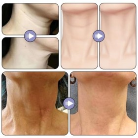 Crème raffermissante pour le cou et le cou,crème pour le cou raffermissante et liftante, crème raffermissante pour le cou,crè