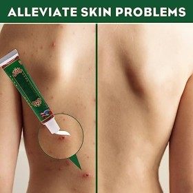 4pcs Creme Anti Demangeaison Crème à Base De Plantes Crème RéParatrice Hydratante Crème Anti Démangeaisons Aux Herbes Apaisan