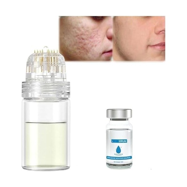 Système de micro-perfusion pour les lèvres, micro système pour le visage, système facial avec sérum, rouleau de microfléchett