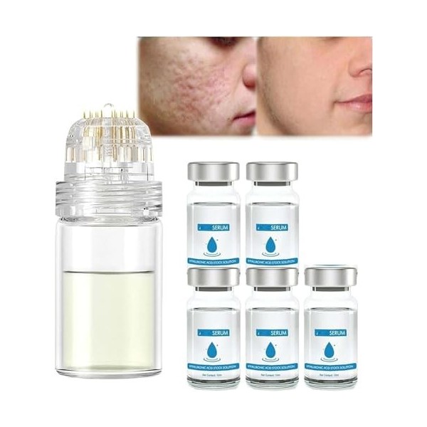 Système de micro-perfusion pour les lèvres, micro système pour le visage, système facial avec sérum, rouleau de microfléchett