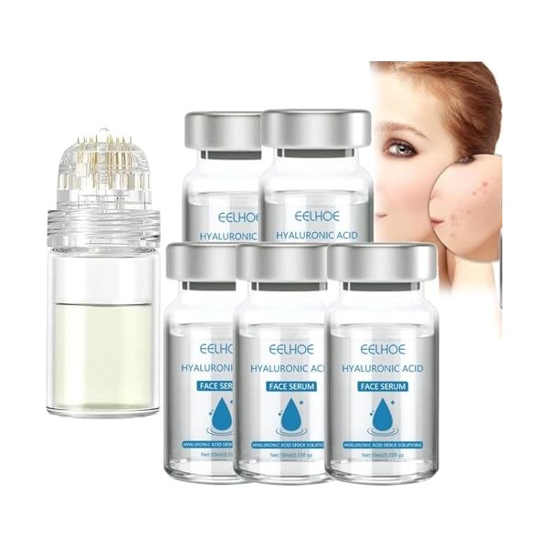 Système de micro-infusion pour les lèvres, système de micro-infusion pour le visage, système de micro-infusion, système facia