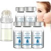 Système de micro-infusion pour les lèvres, système de micro-infusion pour le visage, système de micro-infusion, système facia