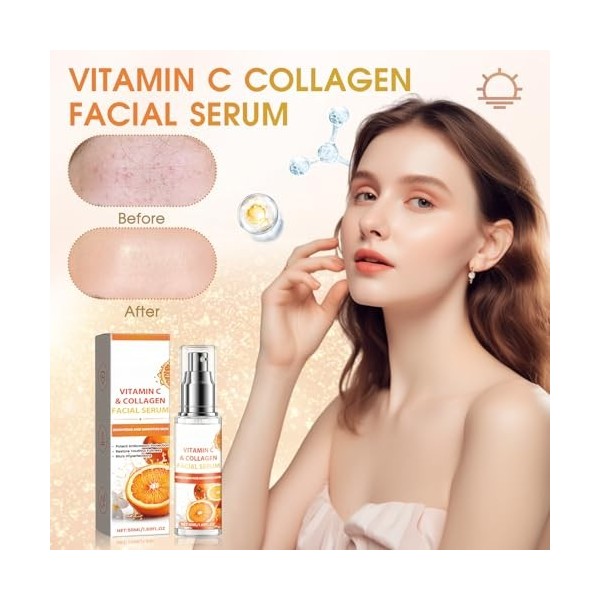 Allony Serum Hydratant Anti Tache Visage, 50ml Vitamine C Serum Visage+50ml Retinol Serum Visage, Sérum Vitamine C, éclaircir