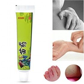 Crème anti-démangeaisons, Onguent anti-démangeaisons doux et efficace Crème à base de plantes pour les démangeaisons de la pe