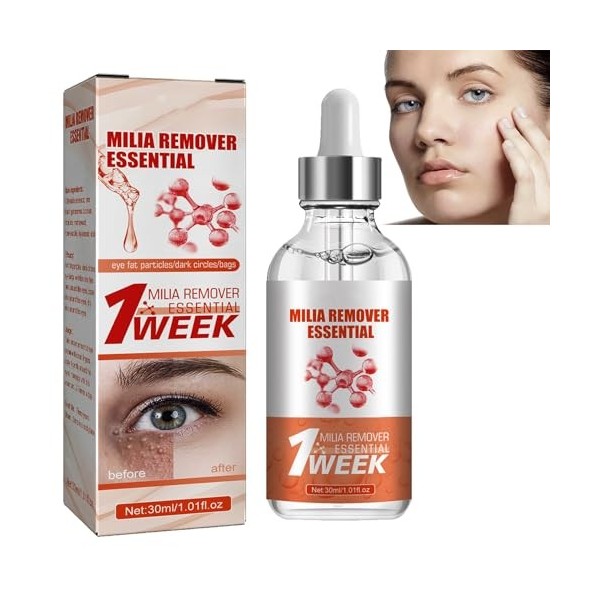 KOAHDE Milia Removal Sérums pour le visage, traitement des taches Milia pour le visage, sérum pour le visage, sérum anti-tach