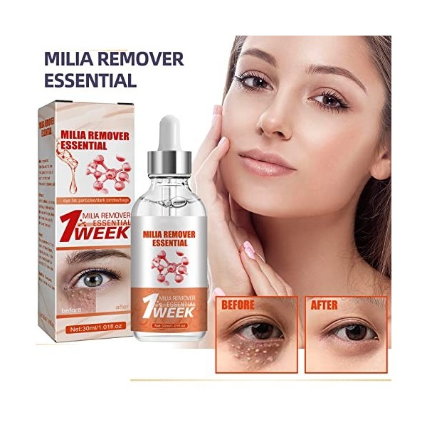 KOAHDE Milia Removal Sérums pour le visage, traitement des taches Milia pour le visage, sérum pour le visage, sérum anti-tach