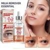 KOAHDE Milia Removal Sérums pour le visage, traitement des taches Milia pour le visage, sérum pour le visage, sérum anti-tach