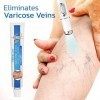 VeinsHealth Varicose Veins Blue Light Therapy,Stylo Anti-varicos Denlèvement de Veine,stylo de veines variqueuses de thérapi