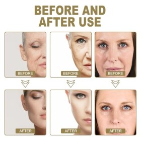 Essence Anti-Rides Anti-âge,Essence Anti-Rides Hydratant, Soin Visage Hydratant, Repulpant & Lissant, Anti-taches, Anti-âge e