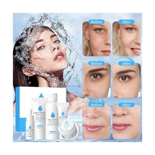 Fengyang® Coffret De Soins Hydratants, Kit De Soins De La Peau Hydratants Et Nourrissants Quotidiens, Set Déclat Pour La Pea