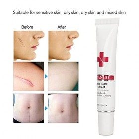 Crème Anti-Cicatrices, Crème Anti-Cicatrices pour les Vieilles Cicatrices, Crème de Traitement Douce et Sûre pour la Réparati