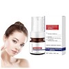 𝐖𝐡𝐢𝐭𝐞𝐧𝐢𝐧𝐠 And 𝐅𝐫𝐞𝐜𝐤𝐥𝐞 Removing Essence,Vitamin C Face Cream,Anti-Spot Serum - Remover Freckle Essence,𝐖𝐡𝐢𝐭𝐞𝐧𝐢𝐧𝐠 𝐒𝐩𝐨𝐭 Creams 