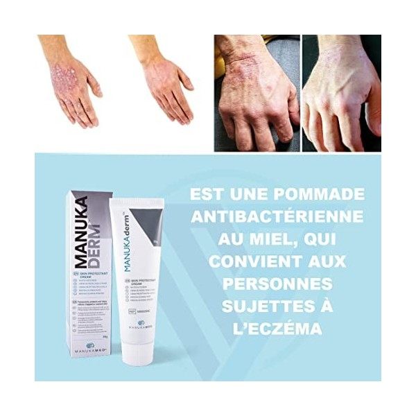 MANUKAmed MANUKA DERM Creme cicatrisante plaie, pour la Peau, Psoriasis, Acne traitement, Dermatite, Eczéma, Peaux seches, Mi