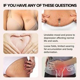 Crème anti-vergetures, 50 ml pour la grossesse – Crème anti-vergetures pour la grossesse, le gain de poids et la musculation