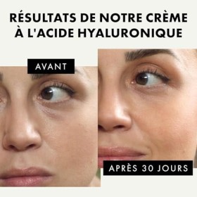 Soin du Visage Cosmétique tout-en-un avec 50% dIngrédient Actif | 75ml | Creme Acide Hyaluronique à base dAloe Vera et dHu