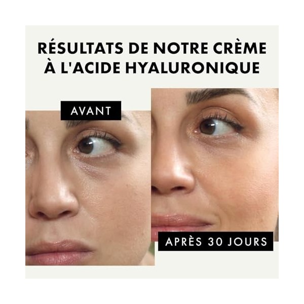 Soin du Visage Cosmétique tout-en-un avec 50% dIngrédient Actif | 75ml | Creme Acide Hyaluronique à base dAloe Vera et dHu