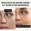 Soin du Visage Cosmétique tout-en-un avec 50% dIngrédient Actif | 75ml | Creme Acide Hyaluronique à base dAloe Vera et dHu