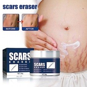 Crème de Cicatrice,Creme Anti Vergeture,Enlever la Crème de Cicatrice pour Réparer et Enlever Les Cicatrices Anciennes et Nou