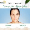 Puglia Cosmesi Bio Malala Acne Pimples Face Cream, pour les peaux grasses et acnéiques, avec acide mandélique, ortie et thym,