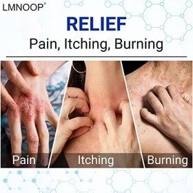 LMNOOP Eczema Cream, Pommade de traitement de force maximale pour le psoriasis,la dermatite,la teigne des pieds,les infection