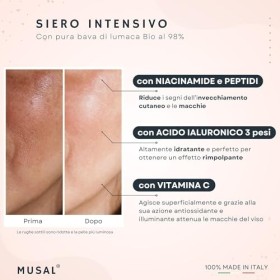 MUSAL Sérum Visage Anti-Rides et Anti-Cernes avec Acide Hyaluronique, Vitamine C et Bave dEscargot Bio, Raffermissant et Hyd