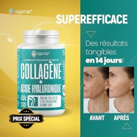Collagene et acide hyaluronique - Collagene 120 comprimes, Articulations Fortes et Peau Hydratée. Collagène, Acide Hyaluroniq