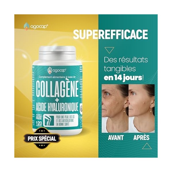 Collagene et acide hyaluronique - Collagene 120 comprimes, Articulations Fortes et Peau Hydratée. Collagène, Acide Hyaluroniq