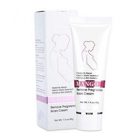 Crème hydratante anti-vergetures, crème hydratante pour le corps, lignes de graisse, éliminer les lignes dobésité resserrer 