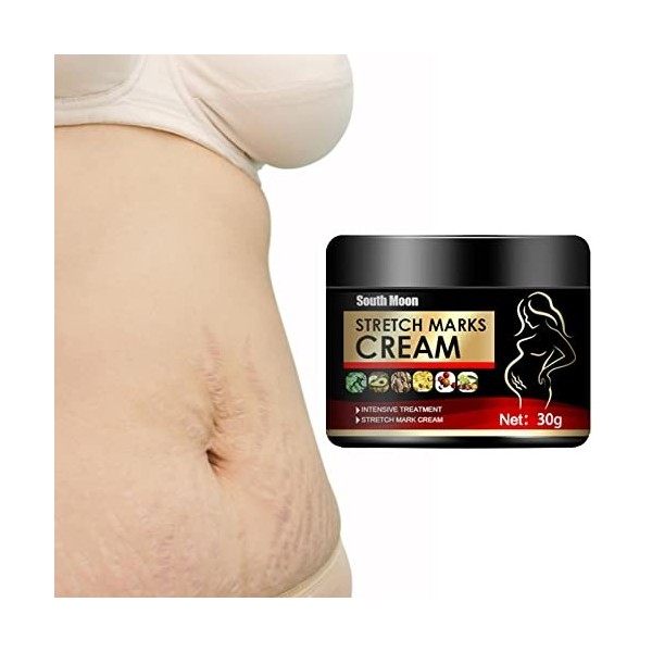 Plesuxfy Crème Intensive Vergetures | Crème Anti-Cicatrices - Crèmes corporelles pour la Grossesse, obésité vergetures hydrat