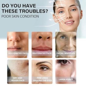 Hydrolyzed 12 * 10PC Fil De Collagène,Fil De Collagene Pour Le Visage,Fils De Soie De Collagène,Fil De Soie Collagène Visage,