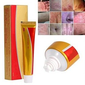 Crème pour le Visage, Crème Naturelle contre le Psoriasis pour le Traitement de Leczéma, Crème de Médecine Chinoise pour les