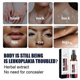 Dermax Spray de traitement du psoriasis, 30 ml en spray de traitement du psoriasis, apaisant et hydratant au goudron, crème p