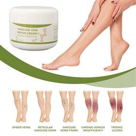 Crème pour les Varices, Traitement des Varices pour les Jambes, 50 G Formule Dhuiles Naturelles Soulagement de la Phlébite T