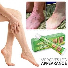 VeinSmoothing&nbsp;Varicose&nbsp;Veins&nbsp;Cream,Crème pour les varices,Crème de Traitement des Varices,crème anti-varices apaisante pour l
