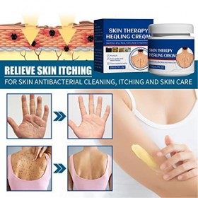 2pcs 20g Peau Psoriasis Crème Apaise Les Rougeurs Sèches Démangeaisons Crème pour Tinea Pedis Corporis Manus Versicolor Crème