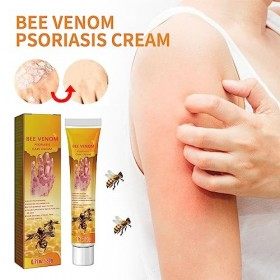 Crème de Traitement du Psoriasis au Venin Dabeille pour Les Jeunes, Crème de Traitement Professionnelle du Psoriasis au Veni