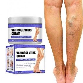 Tkekruh Crème Contre Les Varicosités,Varicose Vein Repair Cream,Réparation Des Jambes DAraignée,Traitement Des Varices Pour 