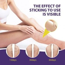 Crème Apaisante pour les Jambes, ANGGREK 0,7 Oz Crème pour les Varices Crème pour le Visage Crème pour le Corps Apaisant pour