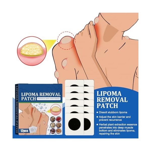 Lot de 12 pansements de soulagement au lipome pour le corps - LumpFree Lipome - Favorise la circulation sanguine - Pansements