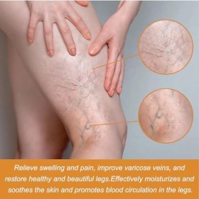 KOAHDE Patch pour varices, patchs apaisants pour les jambes, patch pour la santé des veines, patch pour le traitement des var
