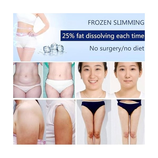 Machinelipolyseminceur,machineamincissanteparcongélation avec 4poignées et 6sondes remplaçables, températureréglable sur 5niv