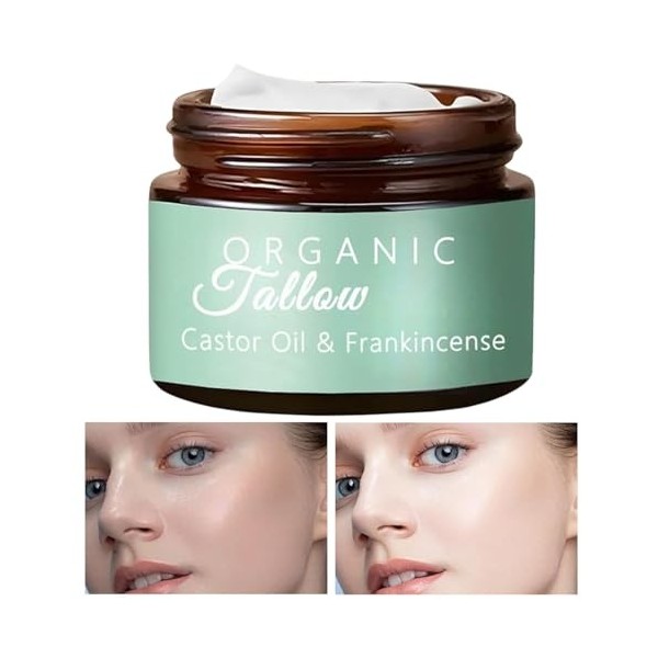 Encens Au Beurre De Karité - Huile De Ricin Avec Encens, Huile De Ricin Et Beurre Pour Le Visage À Lencens, Crème Hydratante