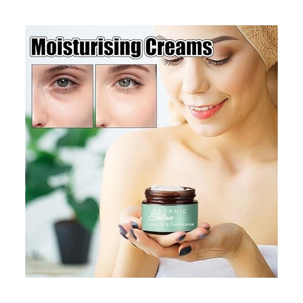 Générique Beef Tallow Castor Oil Frankincense Balm, 141ml Natural Castor Oil Face Butter Frankincense Body Butter, Organic Pu