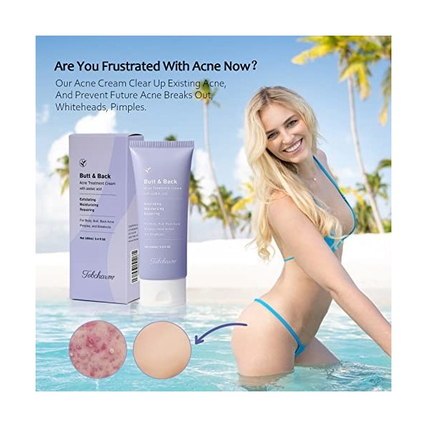 Crème corporelle anti - acné