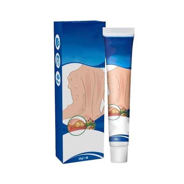 Lipoma Removal Cream,Crème Délimination Des Lipomes,Pommade Apaisante pour Les Lipomes,Pommade de Suppression sûre à Utilise